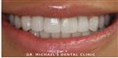 Couture Smile - Dr. Michael’s Dental Clinics