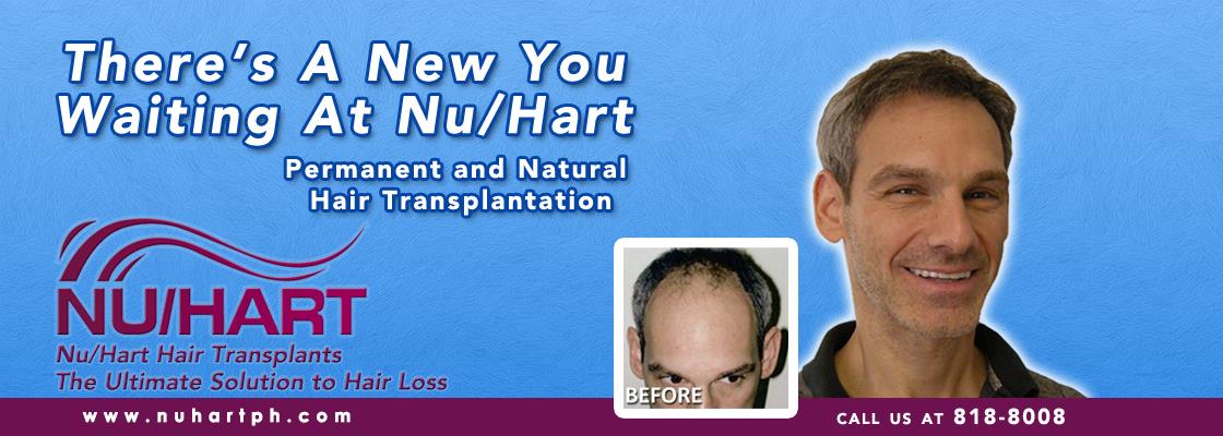 Nuhart Hair Restoration Philippines - 菲律宾显赫植发